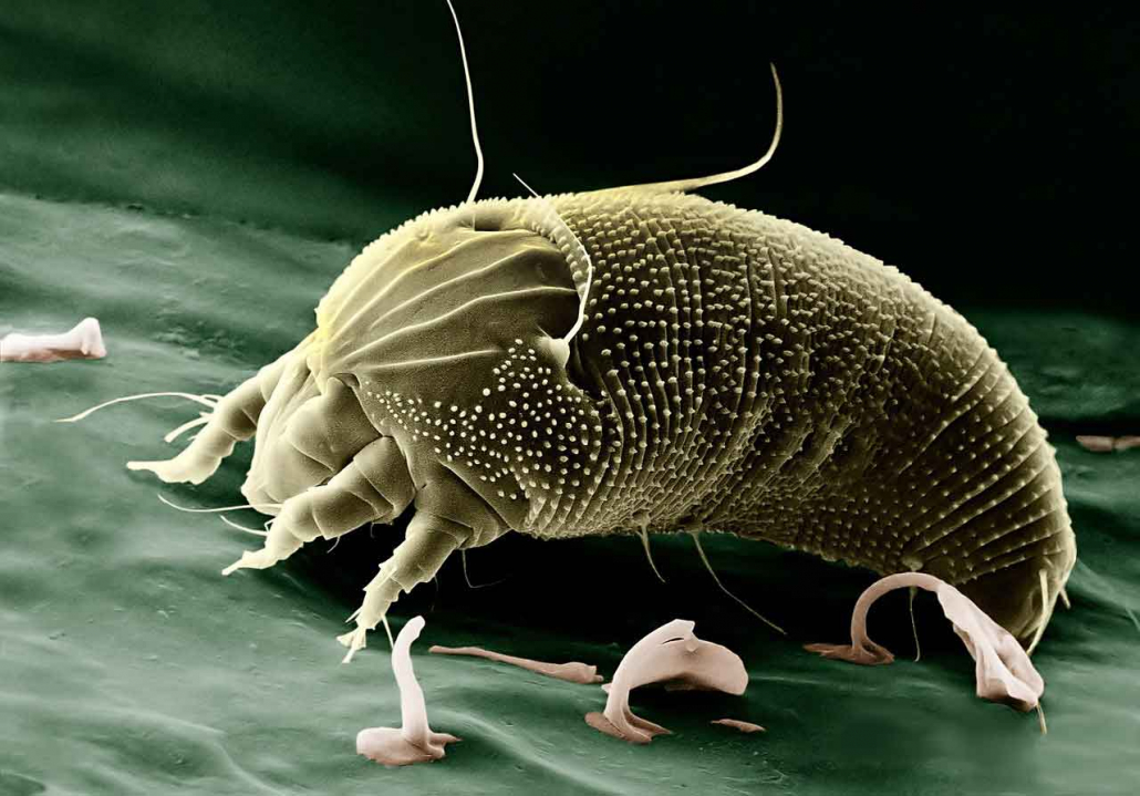 Dust Mite - Acarien